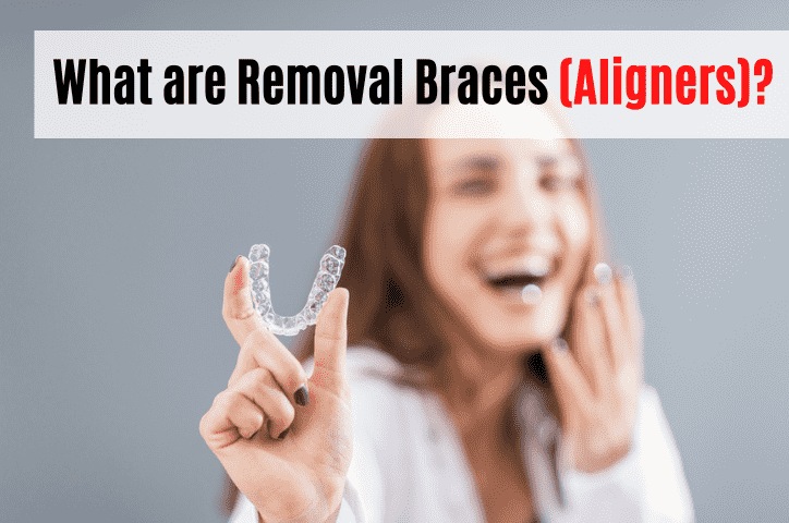 What are Removable Braces