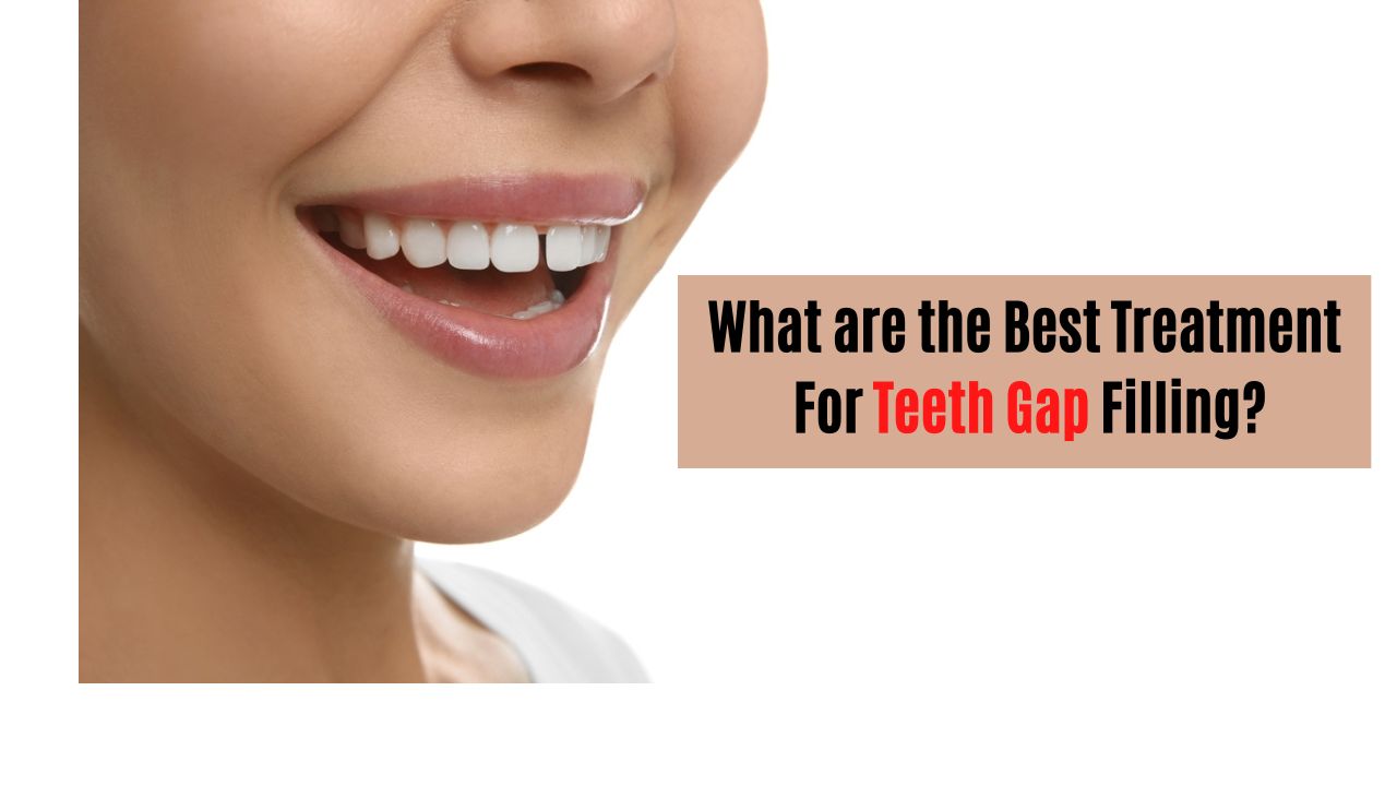 What are the Best Treatment For Teeth Gap